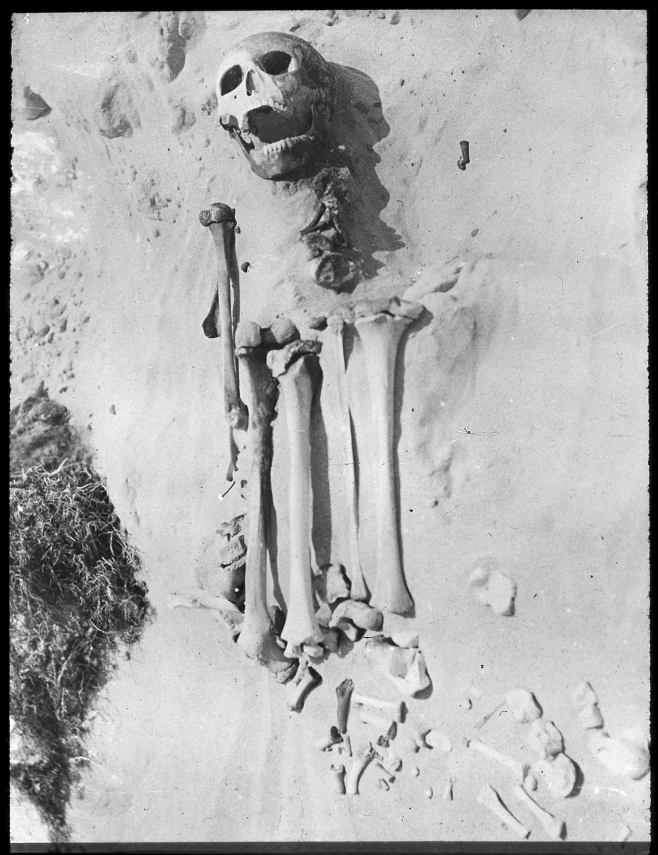 Bilden visar en människoskelett. Det är oklart var bilden är tagen. Bildinformationen från Etnografiska museet är inte heller entydig. Enligt den är bilden från Peru eller Hawaii.
