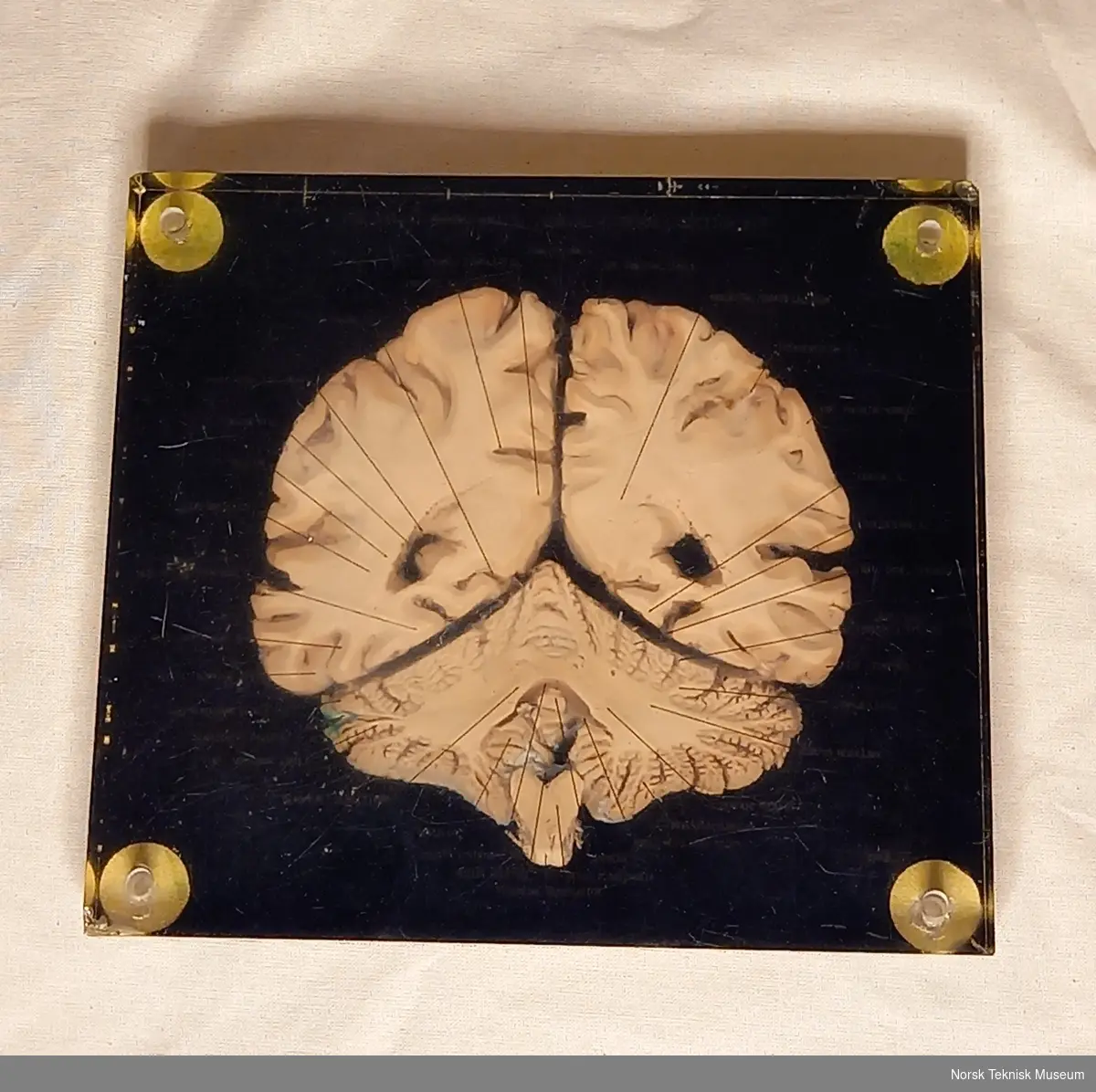 Tverrsnitt av hjerne i glasslignende materiale med påført tekst som viser til forskjellige hjernedelene med svart bakgrunn.