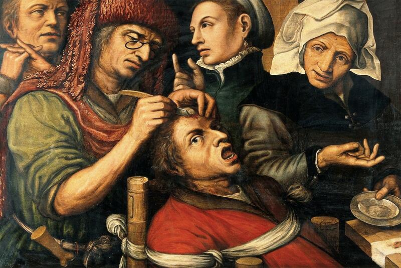 Et gammelt maleri hvor en mann blir operert i hodet. Flere mennesker står rundt og ser på. Mannen ser redd ut