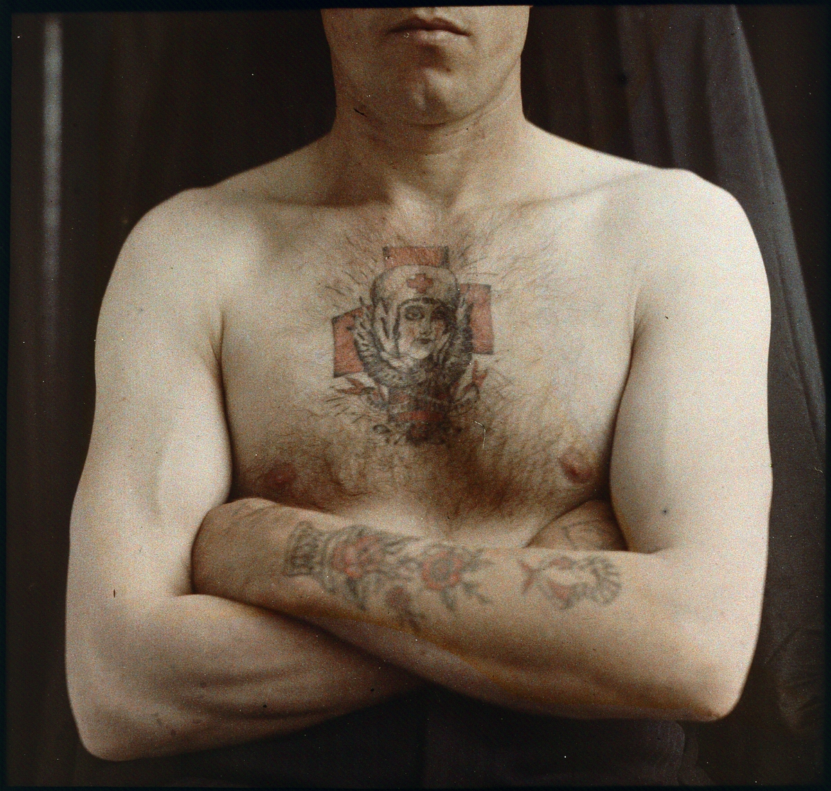 Agfa-autokrom. Medicinska fotografier.
Tatuering på arm och bröst.