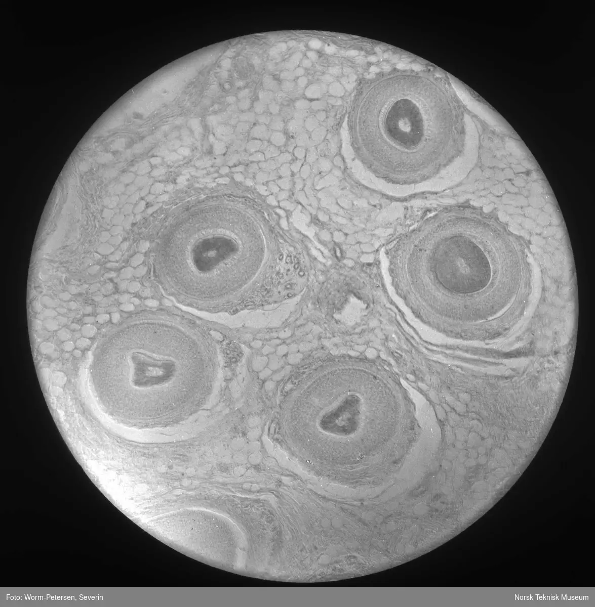 Mikroskopbilde